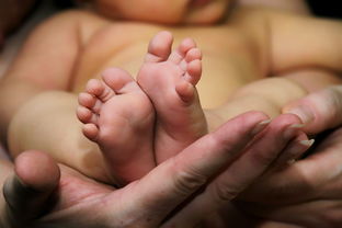 妊娠期肝内胆汁淤积症顺产好还是剖腹产好？